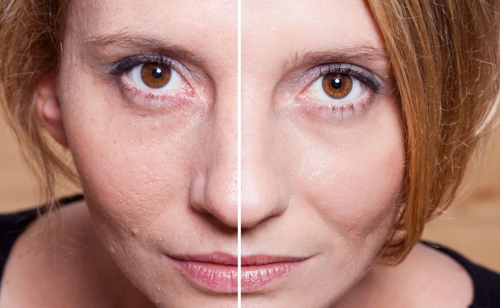 facelift before and after 50 years old