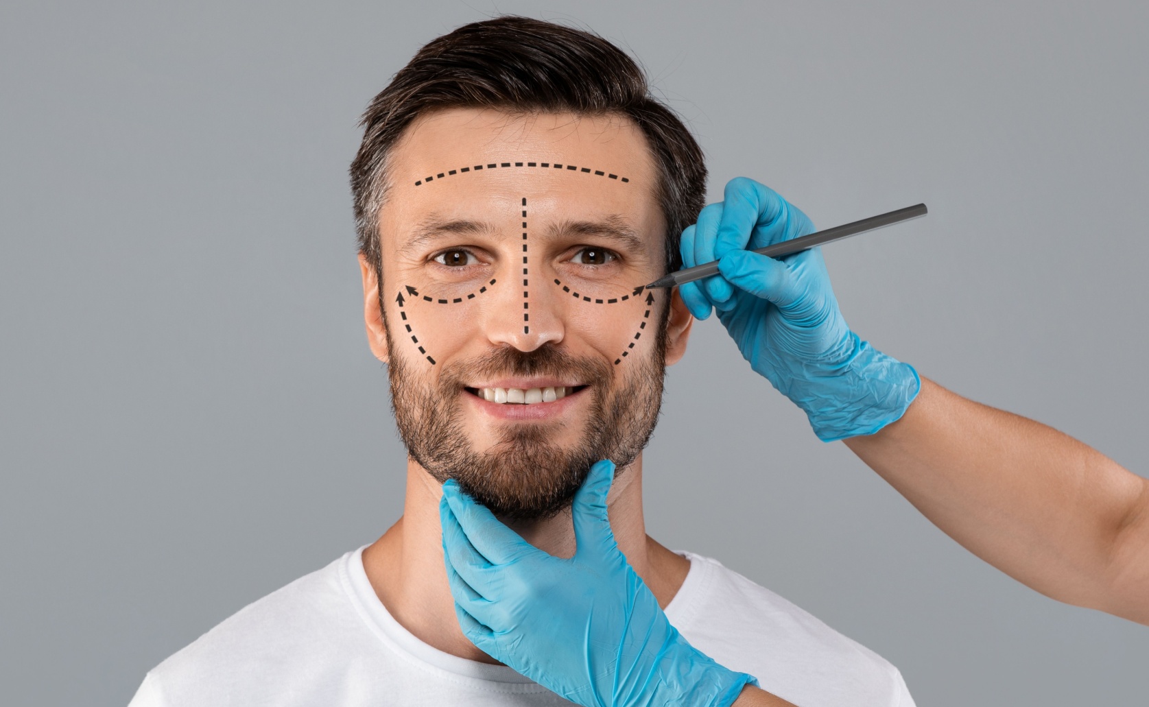 facelift for men