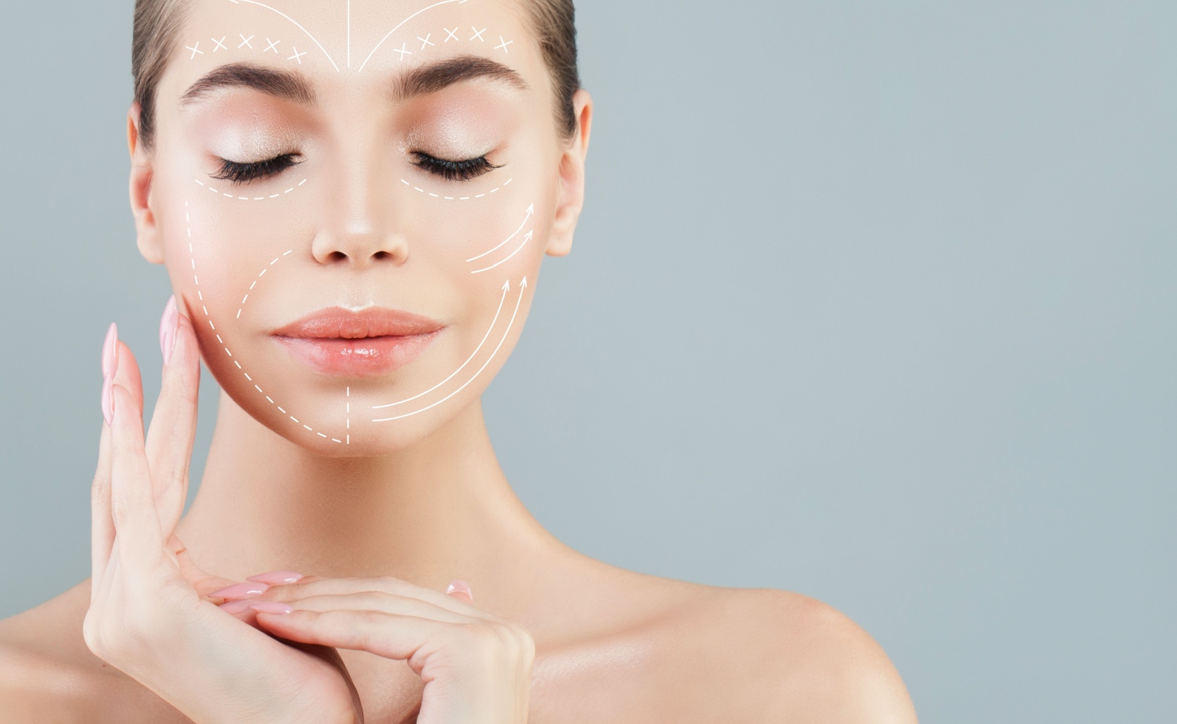 Is facelift permanent