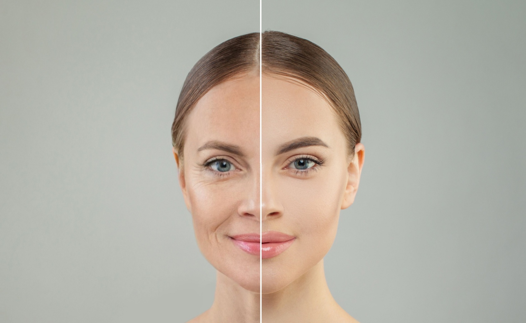 facelifting sugery before and after