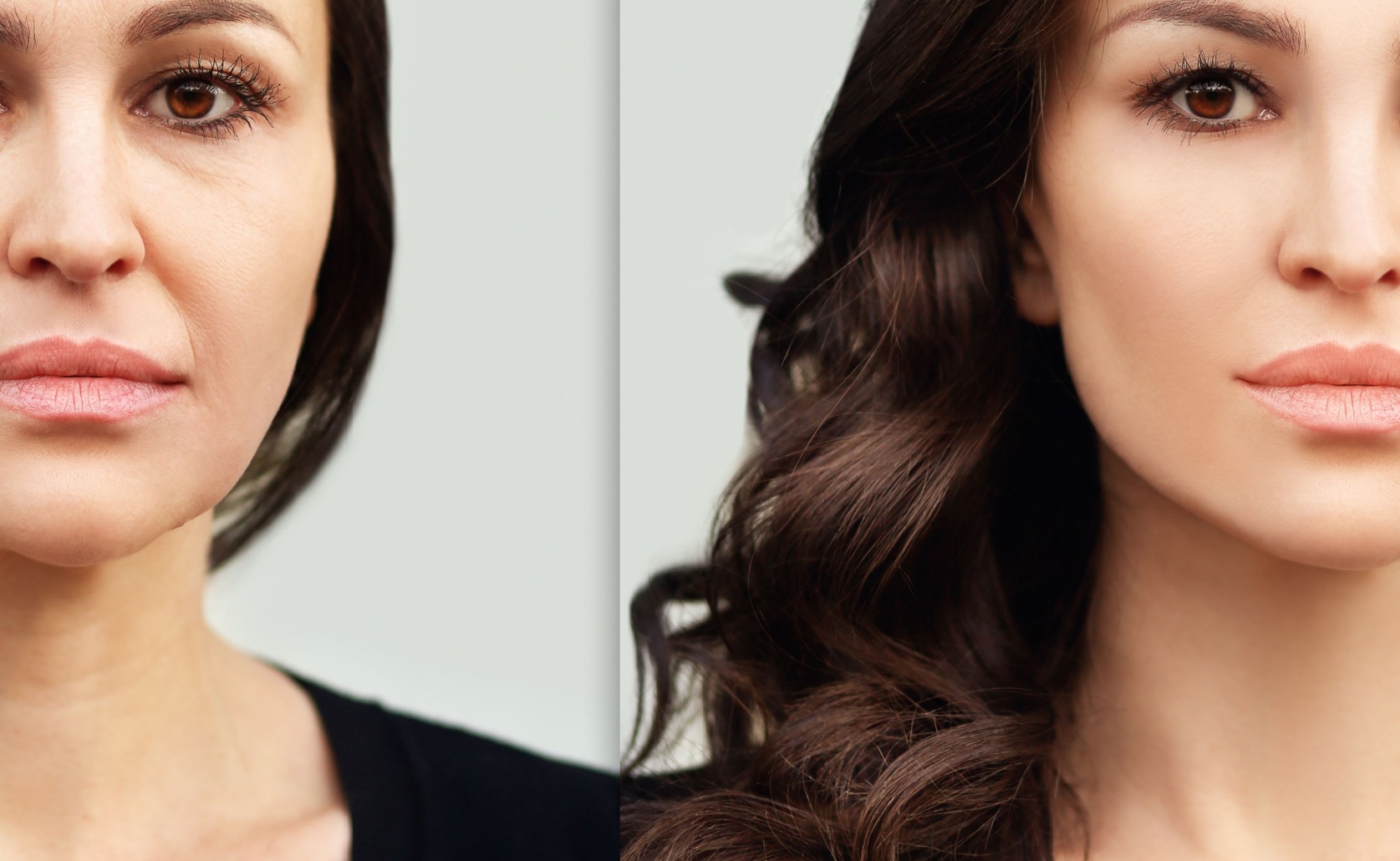 Before and after facelift Sunninghill surgeon