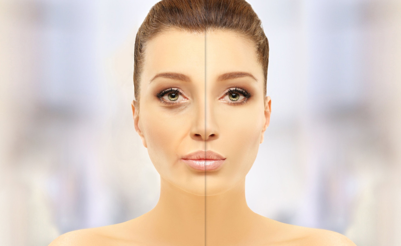 Before and after facelift photos in Rosebank